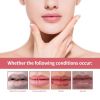 Jaysuing Lip Care Lip Oil, ing Dry And Cracked, Moisturizing And Smoothing Lip Lines Lip Oil